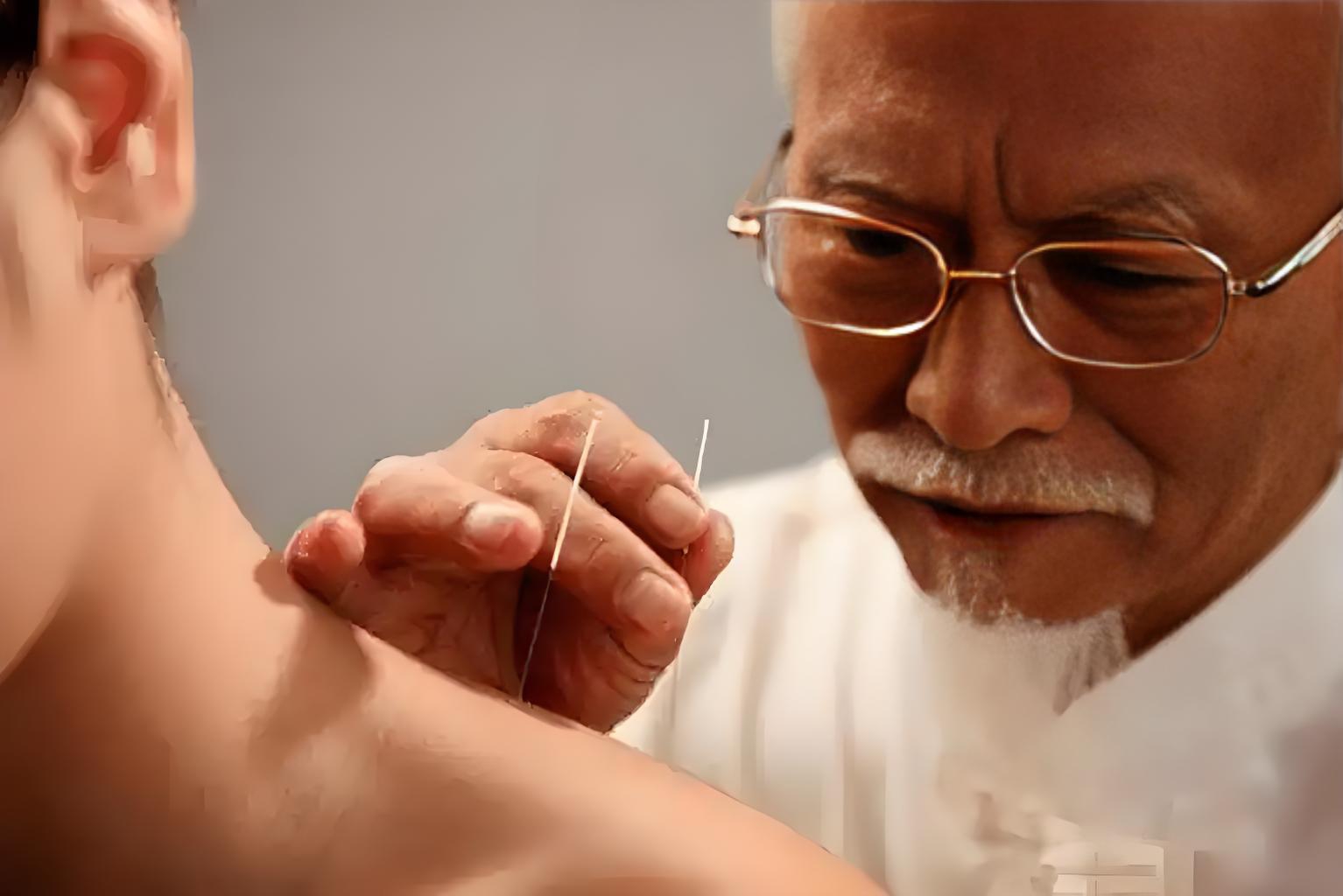 针灸.jpeg